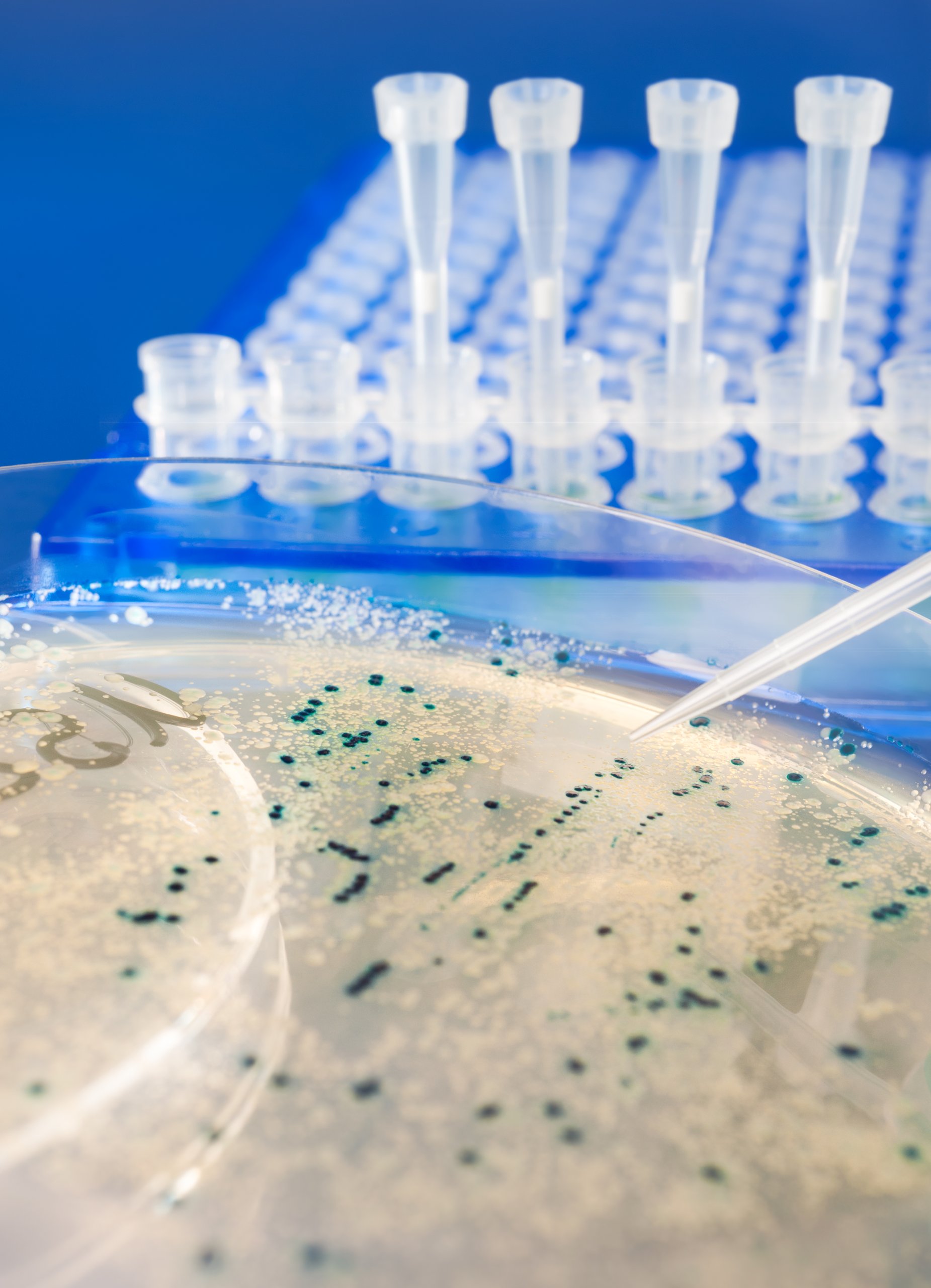 Ταυτοποίηση Μικροοργανισμών σε επίπεδο είδους, Αναλύσεις Φαρμάκων, Εργαστήριο Αναλύσεων Φαρμάκων, ανάλυση μικροβιακής επιμόλυνσης